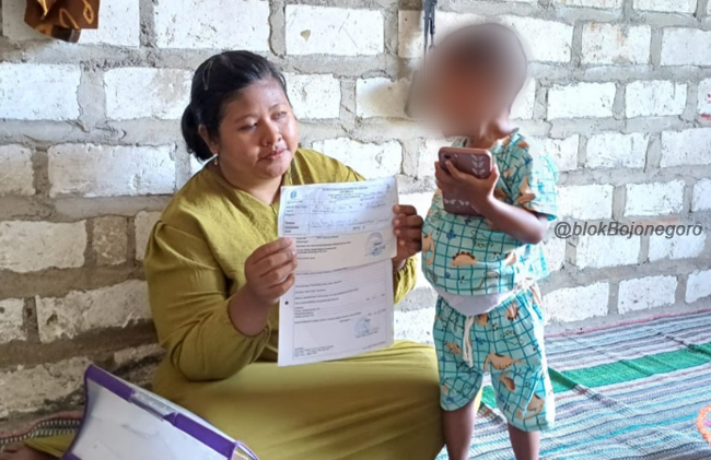 Kisah Pilu Balita di Bojonegoro, Kelainan Sejak Lahir Harus Antre Operasi 2 Tahun