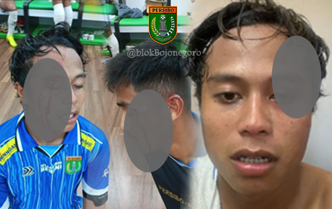 Terluka dan Berdarah, Pemain Persibo Bojonegoro Jadi Korban