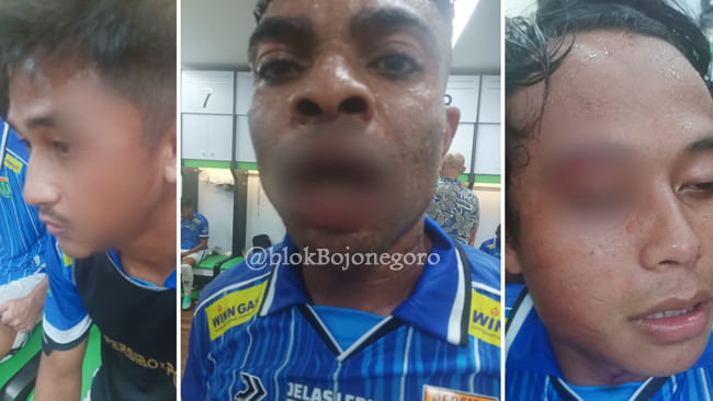 Manajemen Persibo: 3 Pemain Laskar Angling Dharma Luka Parah